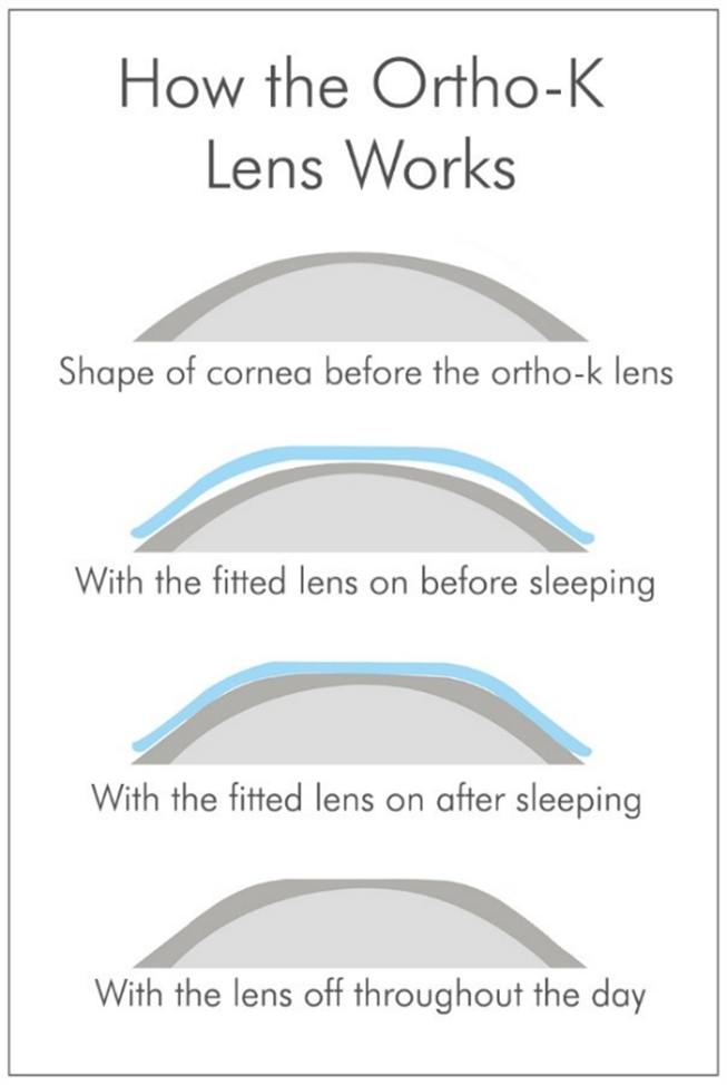 How the Night Lens process works